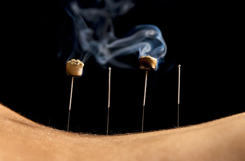 moxibustion